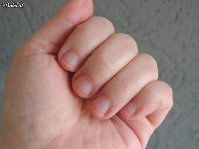 Byte-X Anti-Nagelbijt Pen