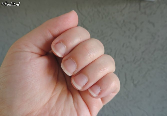 Byte-X Anti-Nagelbijt Pen