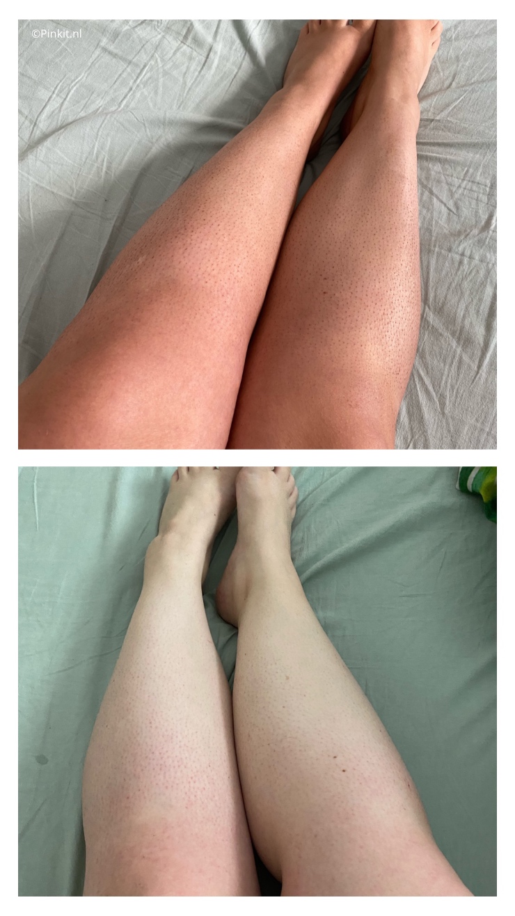 Het merk Australian Glow is nieuw in Nederland, dit merk heeft diverse zelfbruiners in het assortiment. Ik ben aan de slag gegaan met de Australian Glow Self Tan Mousse & Gradual Tanning Lotion, van beide producten laat ik het resultaat in dit artikel zien.